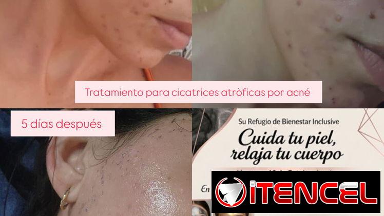 Tratamientos faciales y corporales, tu bienestar es mi prioridad — foto 4