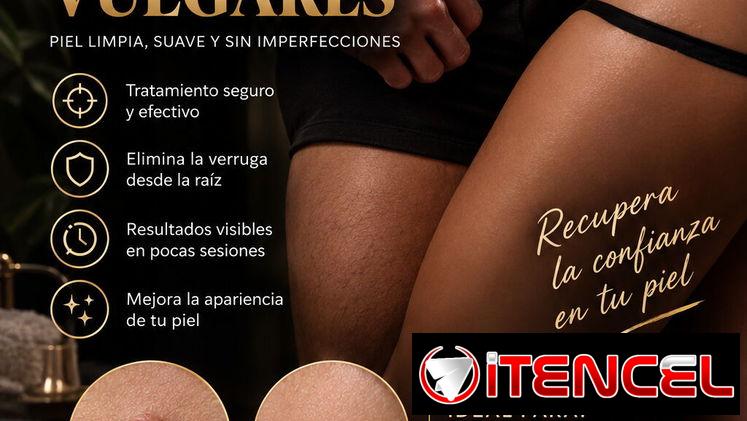 Eliminación de verrugas Vulgares