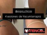 VACUMTERAPIA DE GLÚTEOS CON COPAS COLOMBIANAS EN LA HABANA  ¿Quieres mejorar la apariencia de tus glúteos? ✨  En Espa Ch